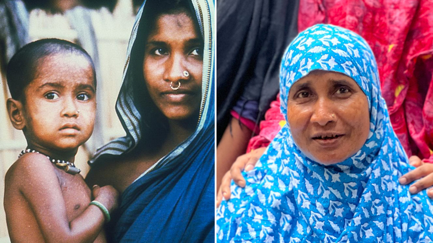 Featured image for "Smallpox Victory's Lessons for 2024 Public Health Threats"