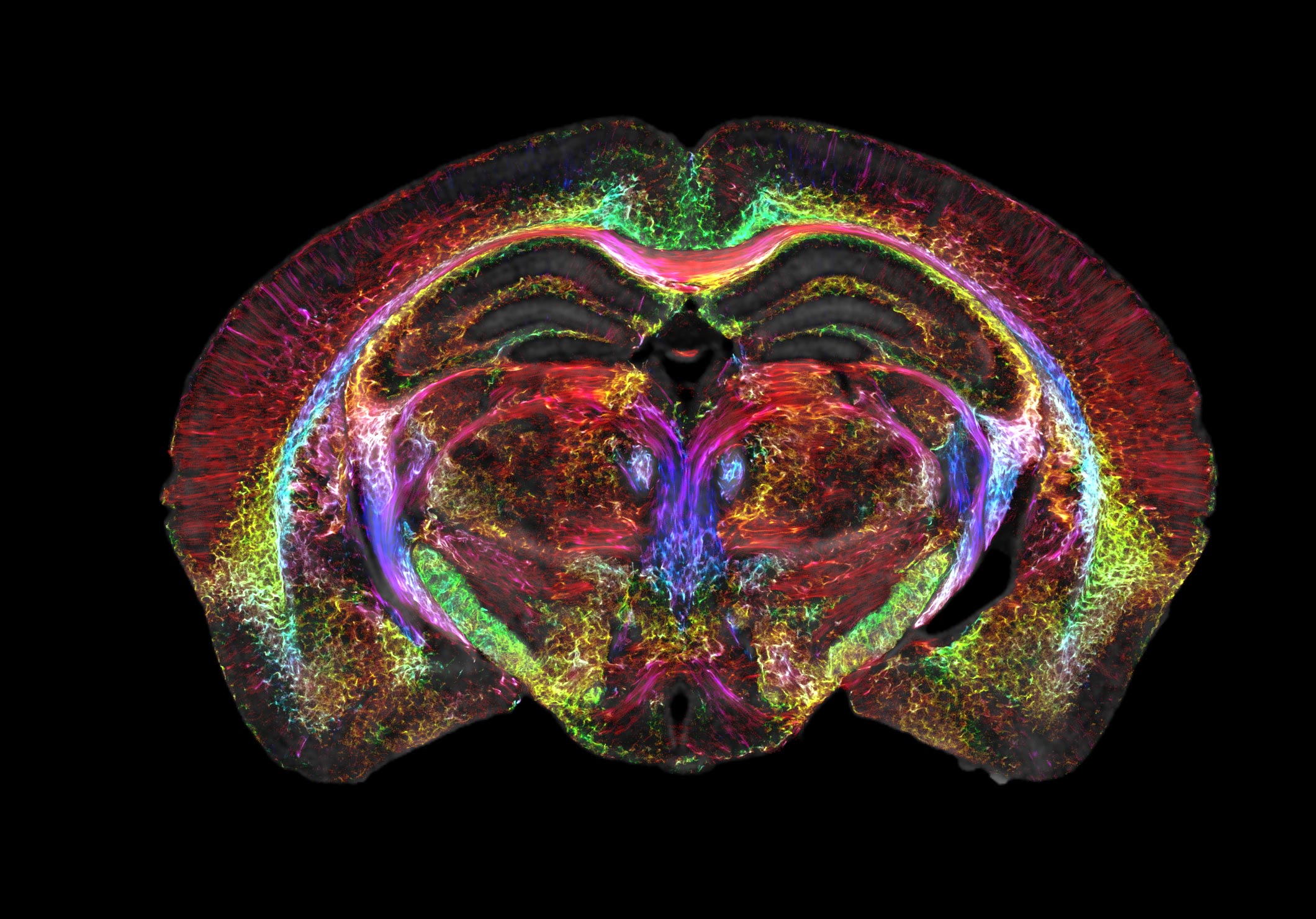 Featured image for Revolutionary Brain Imaging: 64 Million Times Sharper than MRI
