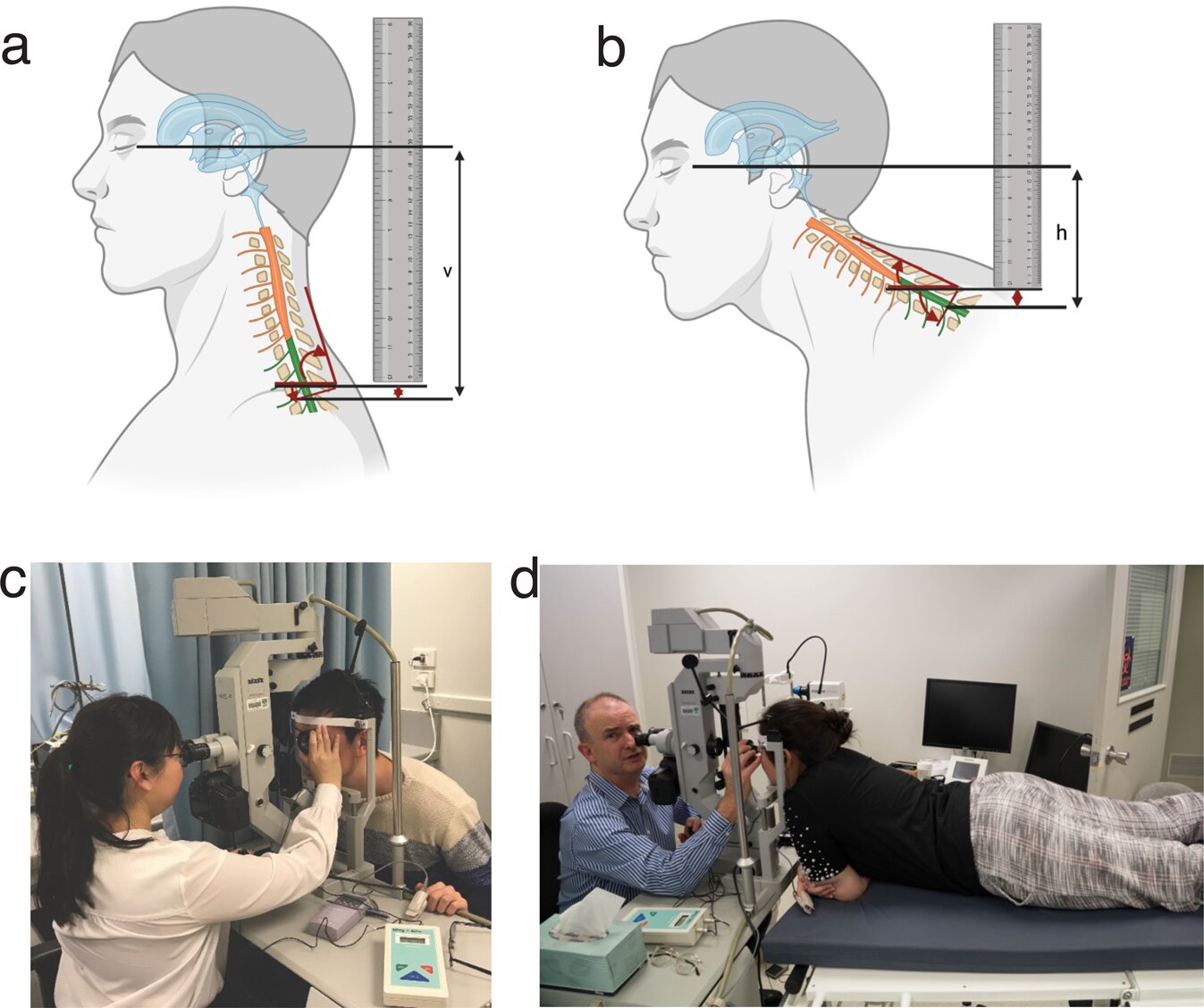 Enhancing Astronaut Eyesight for Extended Space Missions