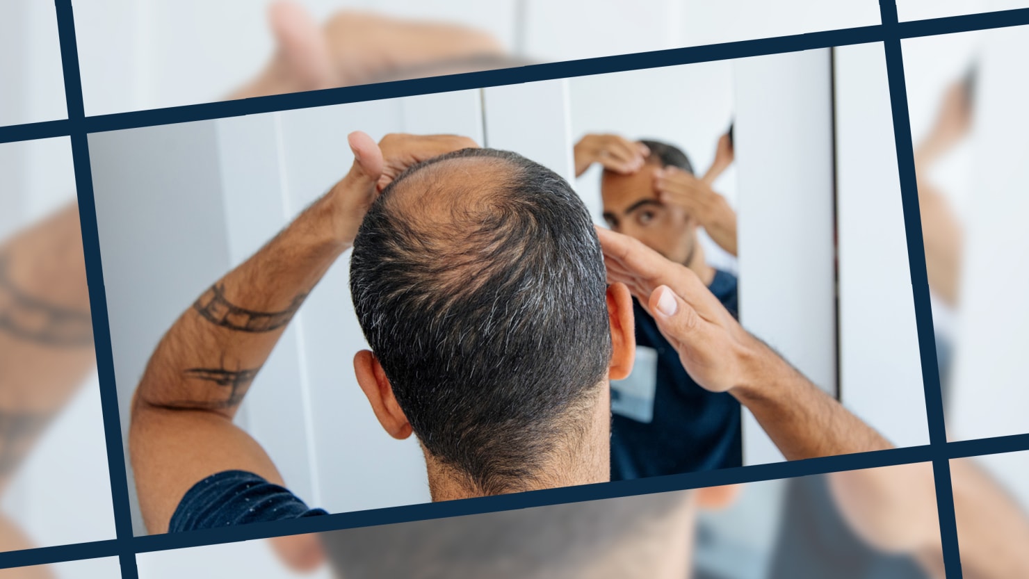 "Effortless Ways to Combat Hair Loss in 2023"