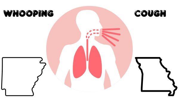 Featured image for US Faces Record Whooping Cough Cases and Rising Deaths Amid Outbreak