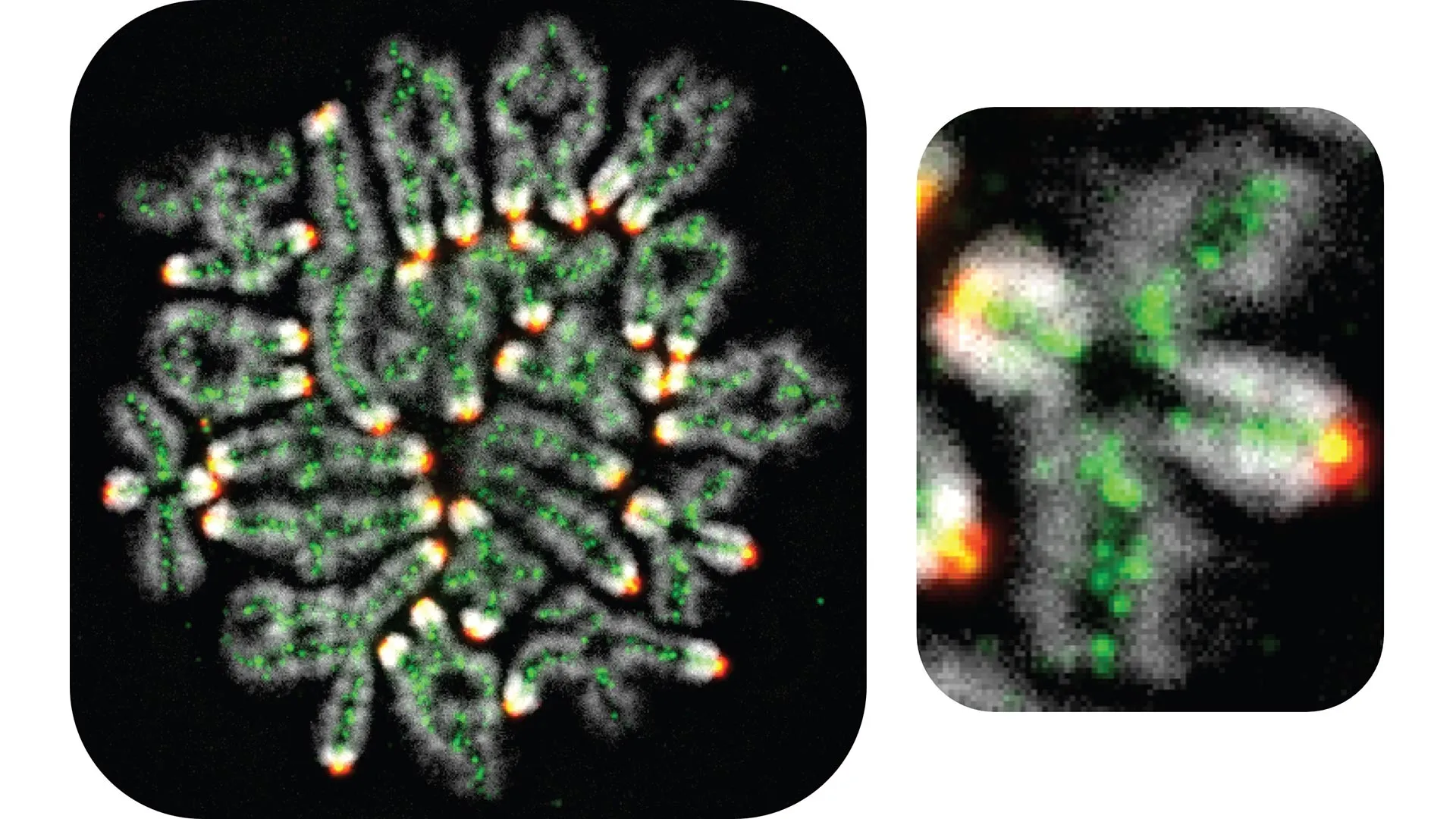 Featured image for Hidden DNA Process Tied to Fertility, Miscarriage, and Down Syndrome Risks