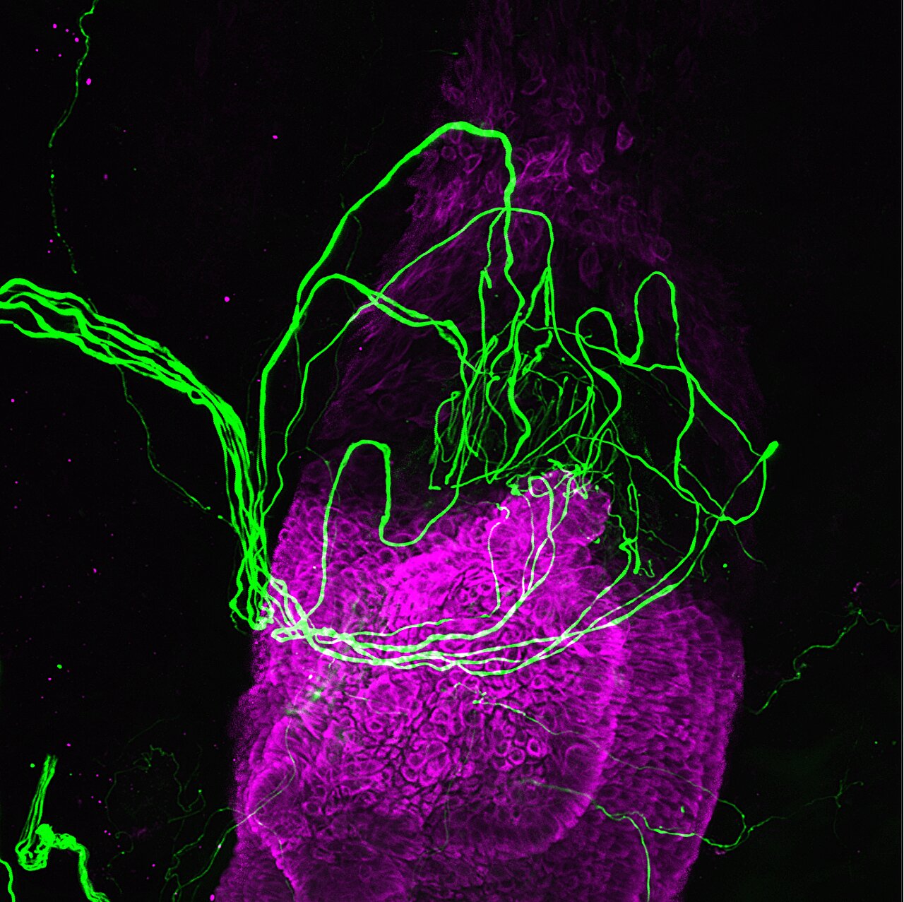 Featured image for Unveiling the Secret Sensory Mechanism of Hair Follicles