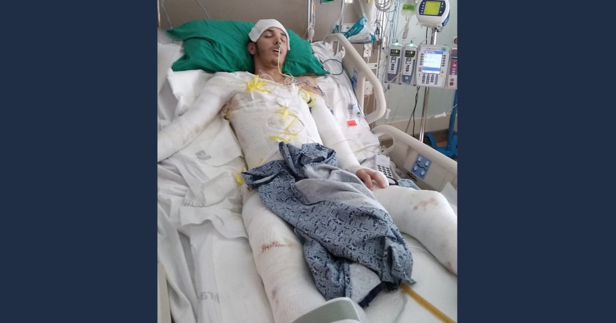 Featured image for Florida Deputy Charged for Setting Man on Fire with Stun Gun at Gas Station