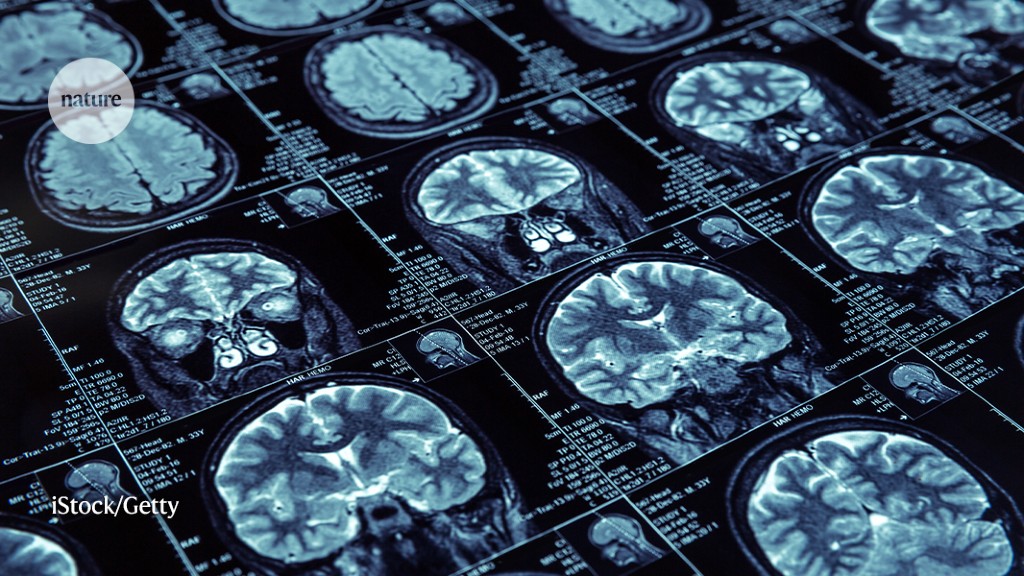 Featured image for Editors stage mass resignations over open-access fees and price hikes.