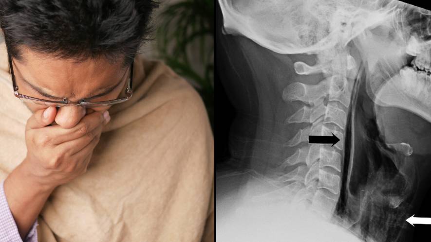 Featured image for "Man Hospitalized After Holding in Sneeze Causes Throat Injury"