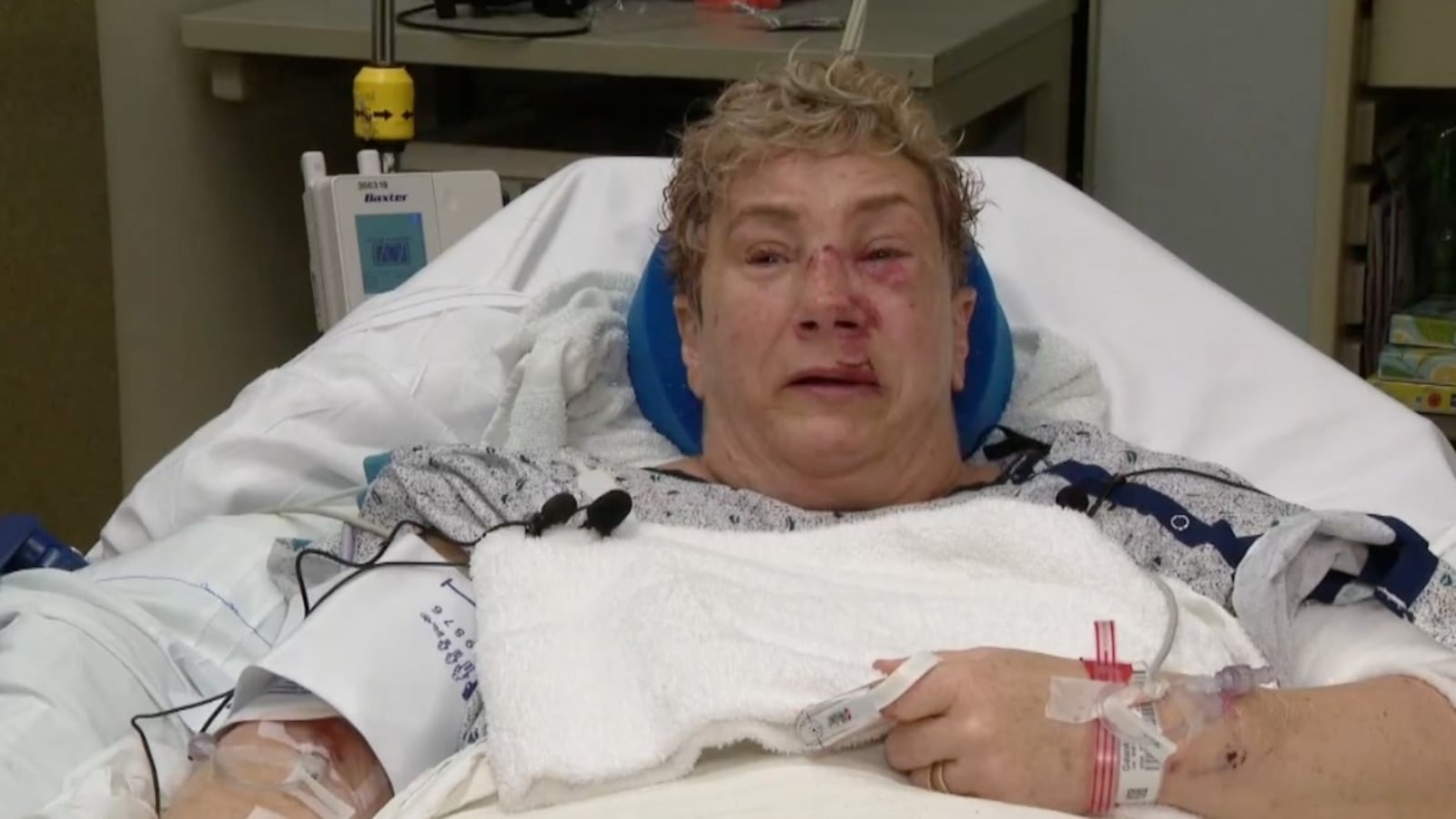 "Pennsylvania Woman Survives Vicious Bear Attack Outside Her Home"