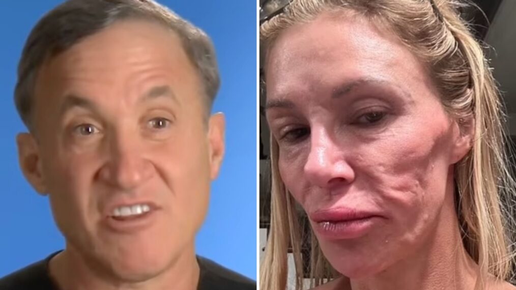 Featured image for Dr. Dubrow Debunks Parasite Theory Amid Brandi Glanville's Facial Ordeal