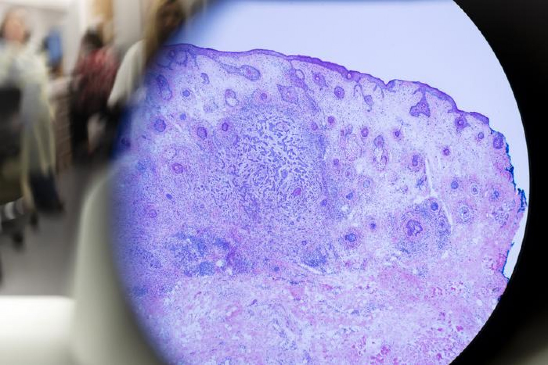 Featured image for "MSK's Breakthroughs Revolutionize Acute Cancer Therapies in Latest Research"