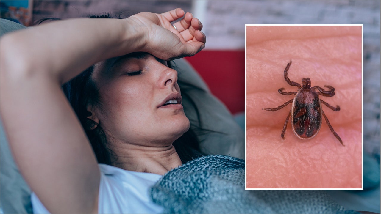 Featured image for CDC Links Deadly Rocky Mountain Spotted Fever Outbreak in California to Mexico