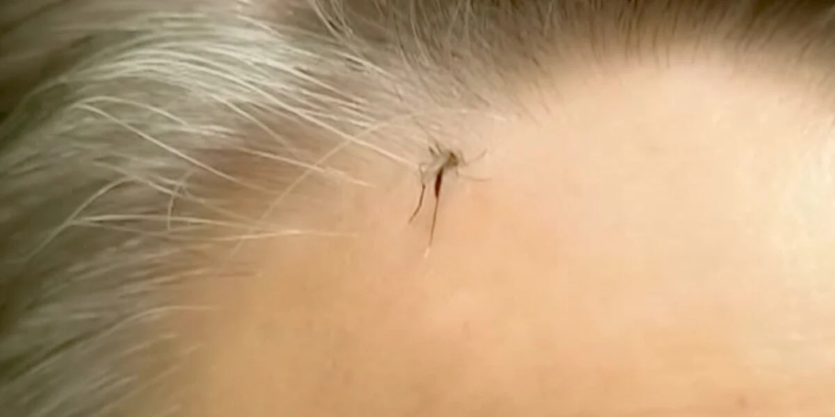 Effective Ways to Keep Mosquitoes at Bay