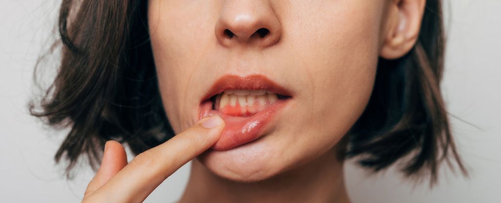 Featured image for Uncovering the Surprising Connection Between the Bubonic Plague and Oral Health