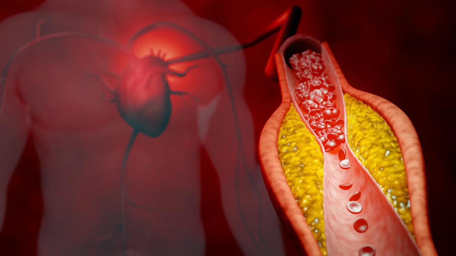 Revolutionary Gene Therapy Halves Cholesterol Without Statins or Side Effects