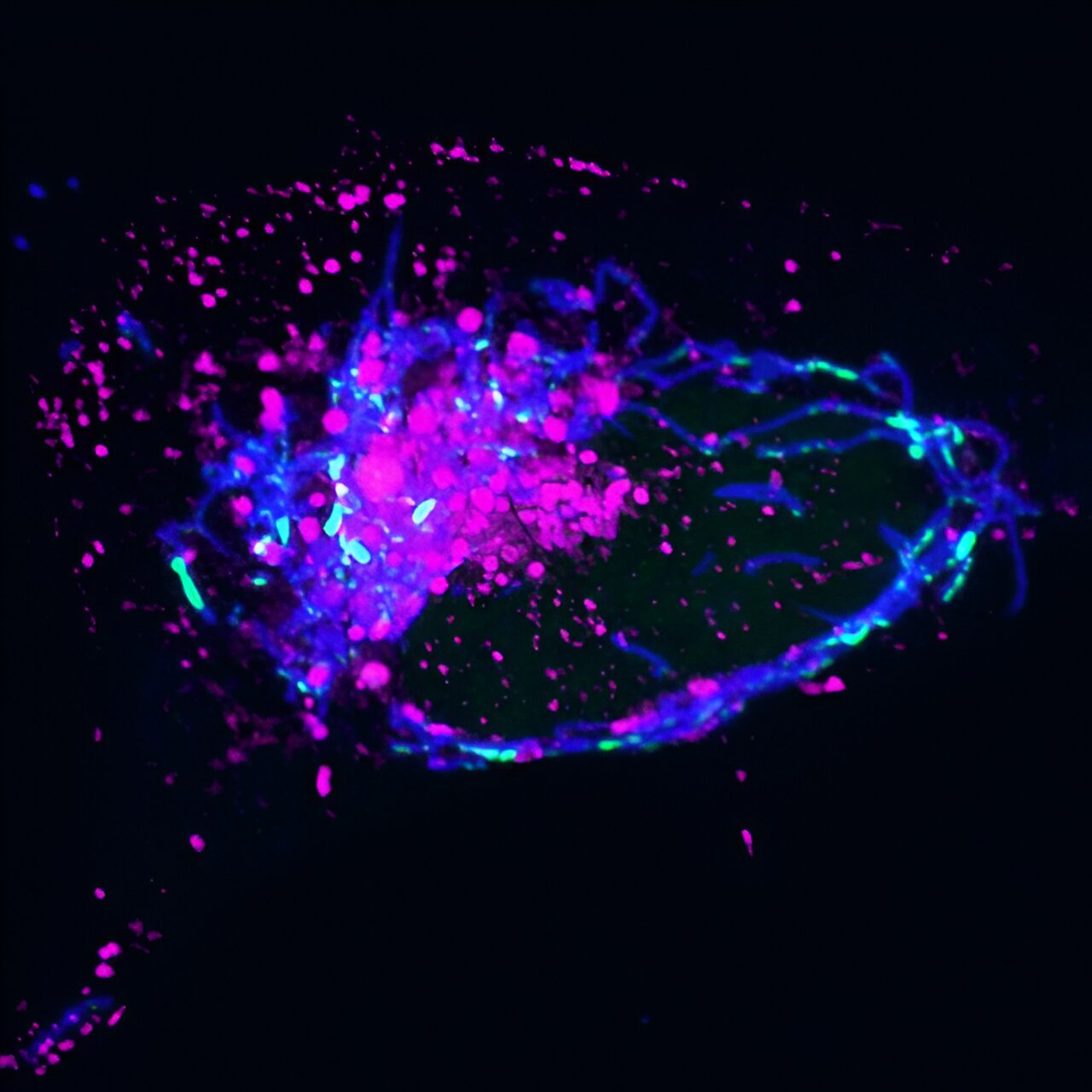 Featured image for "Link Between Faulty DNA Disposal and Inflammation Discovered"