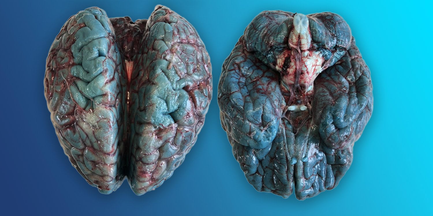 Featured image for Scientists Uncover Cause of Mysterious Blue Brain Autopsies