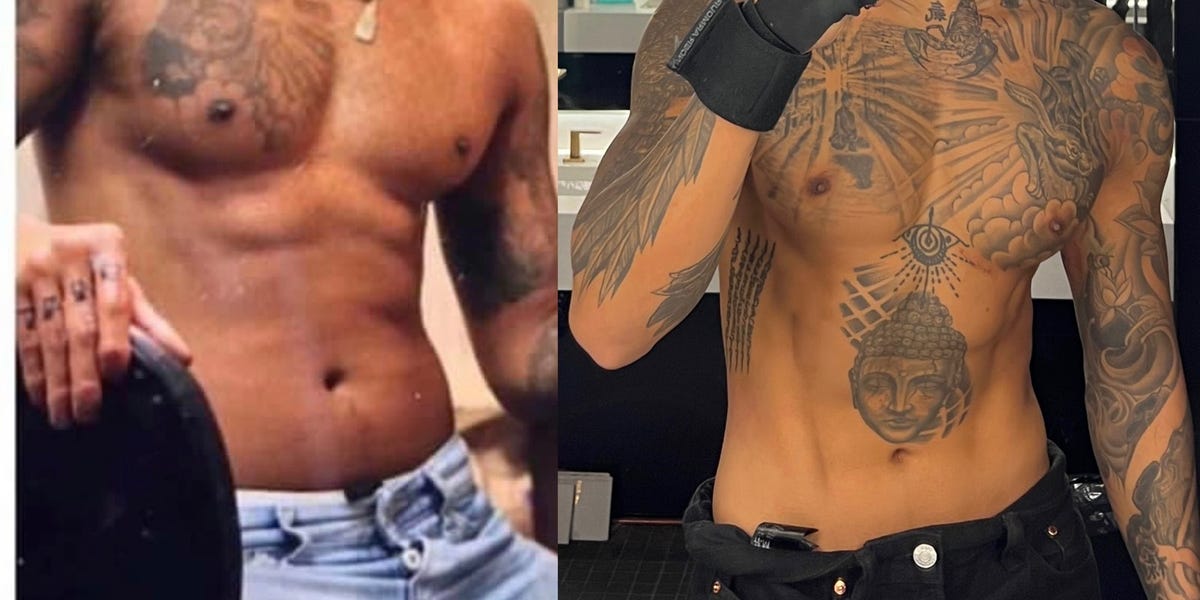 Featured image for Before and After: Man's Abdominal Etching Surgery Transformation