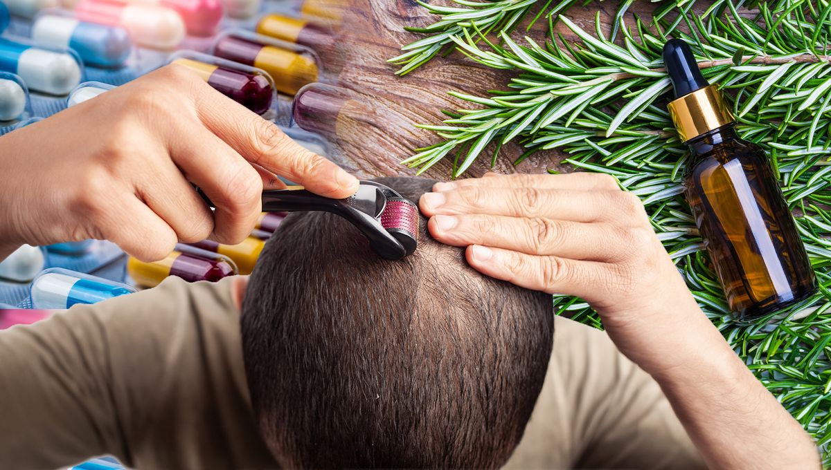 Featured image for "Advancements in Hair Loss Research: From Microneedles to Potential Cures"