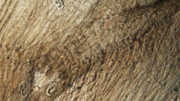 Featured image for Undercooked Bear Meat Causes Rare Worm Infections in U.S. Families