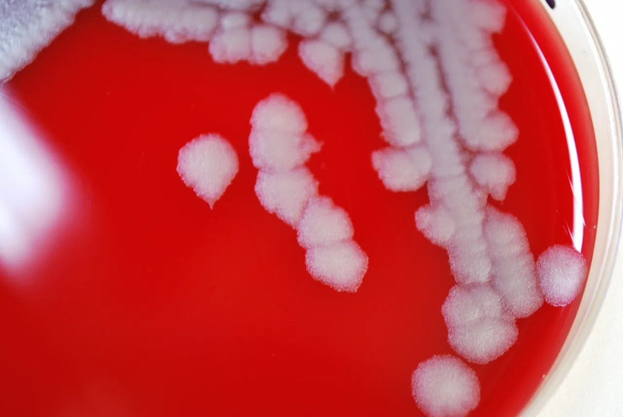 Featured image for "Texas Rancher Contracts Anthrax from Infected Lamb"