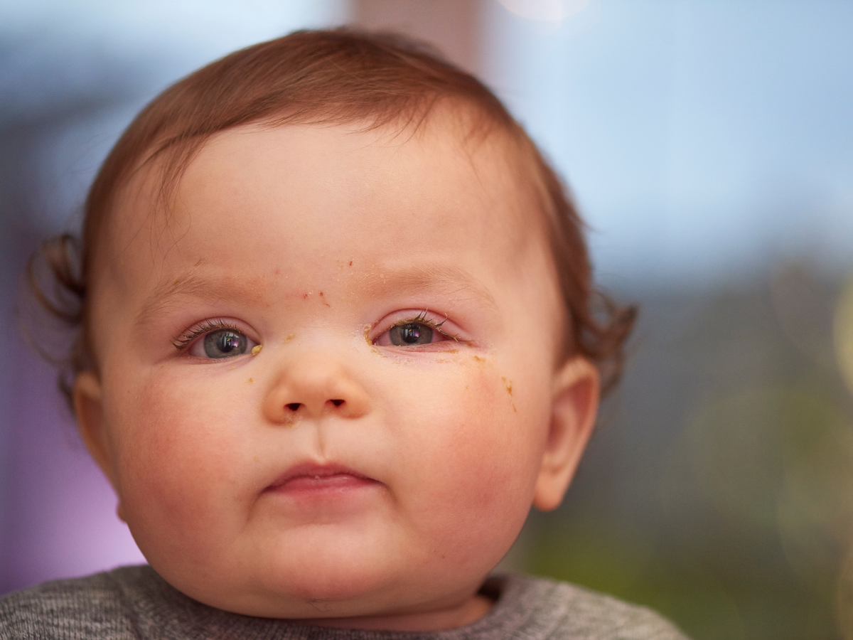 "Rising Concerns: Evolving COVID Symptoms in Children"