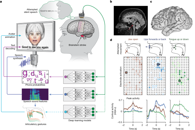 Featured image for Revolutionary Neuroprosthesis Empowers Speech and Communication