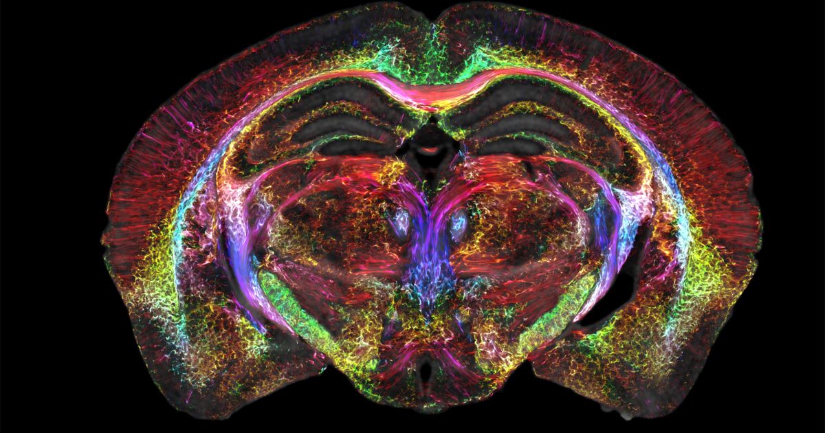 Featured image for Revolutionary Brain Imaging Technology Achieves Unprecedented Clarity.