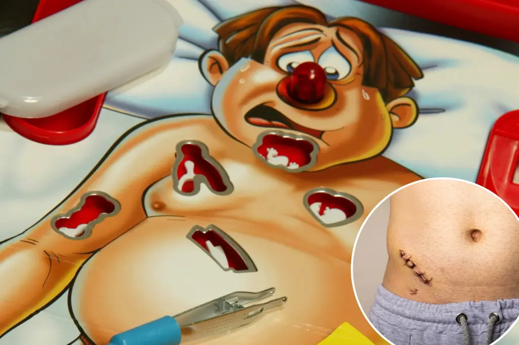 Featured image for 10 Organs You Can Live Without, Including the Body's 'Food Blender'