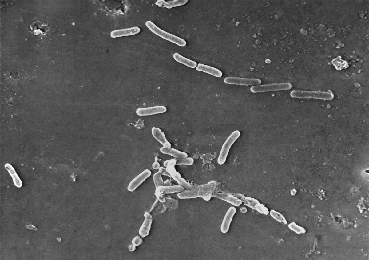 Fatal Outbreak: Bacterial Infection from Recalled Eye Drops Claims More Lives