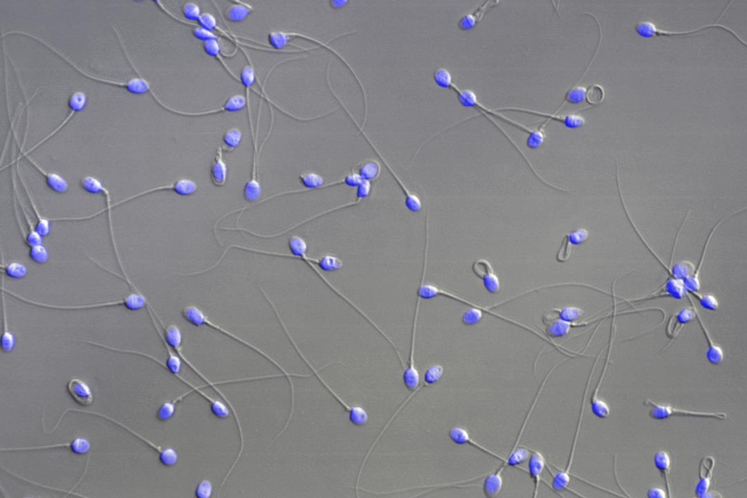 Featured image for AI Helps Achieve Pregnancy After 19 Years of Trying